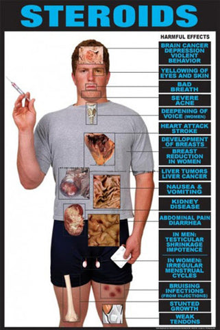 Harmful Effects of STEROIDS Health Educational Fitness Poster - Fitnus Corp.